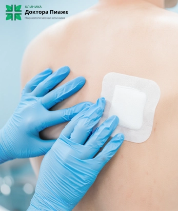 Врач в перчатках накладывает повязку после кодирования