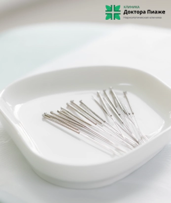 Стерильные иглы для акупунктуры